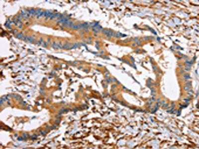DPYSL2 Antibody