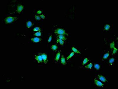 DPYSL2 Antibody