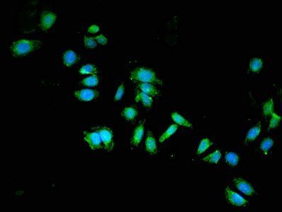 DPYSL2 antibody