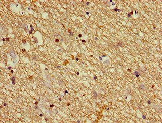 DPYSL2 Antibody