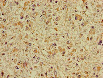 DPYSL2 Antibody