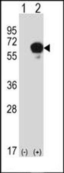 DPYSL3 antibody
