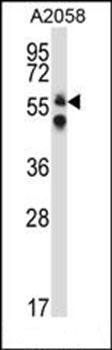 DPYSL3 antibody