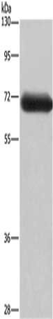 DPYSL3 Antibody