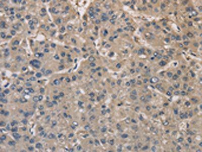 DPYSL3 Antibody