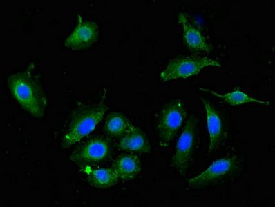 DPYSL4 antibody