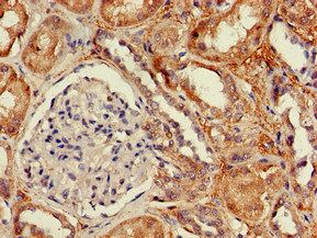DPYSL4 Antibody