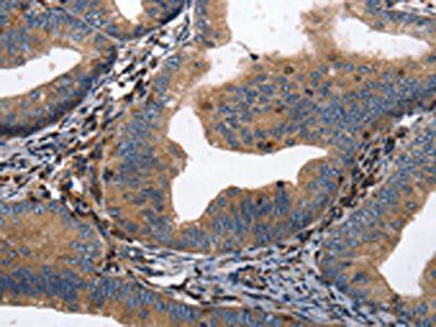 DPYSL4 antibody