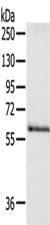 DPYSL5 antibody