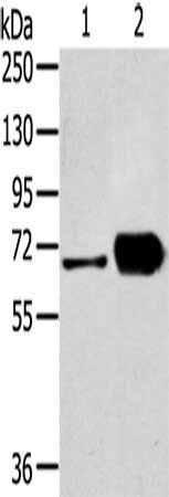 DPYSL5 Antibody