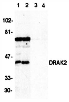 DRAK2 Antibody