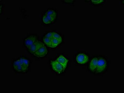 DRAM2 Antibody