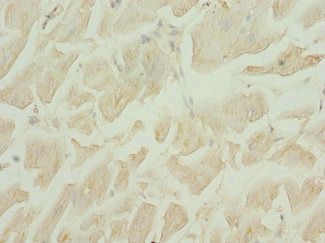 DRAM2 Antibody