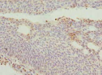 DRAM2 Antibody