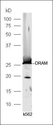 DRAM antibody