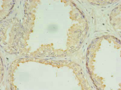 DRC7 Antibody