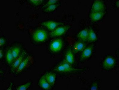DRD1 Antibody