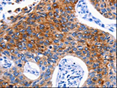DRD4 Antibody