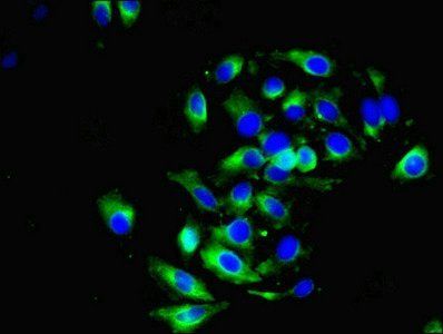 DRD5 Antibody