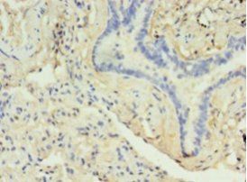 DRD5 Antibody