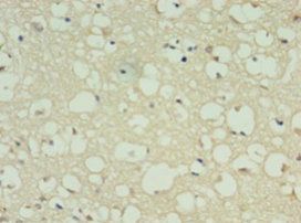 DRD5 Antibody