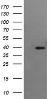 ZBED1 Antibody