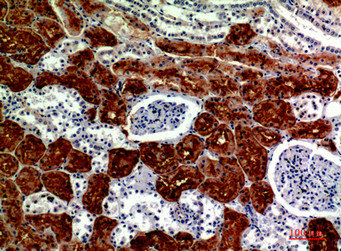 DROSHA Antibody