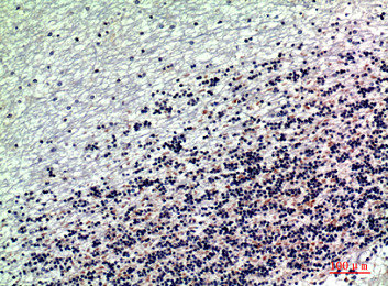 DROSHA Antibody