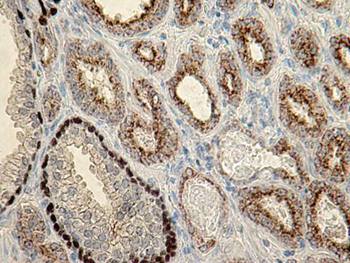 PIN-Cocktail 1 --- P504S / p63 Antibody