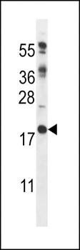DSCR1L1 antibody