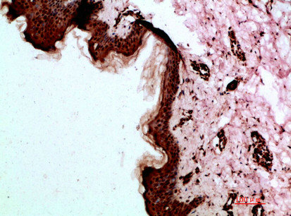 DSG1 antibody