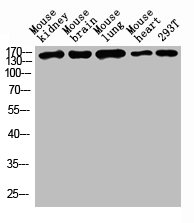 DSG1 antibody