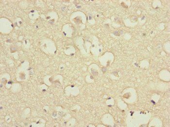 DSN1 Antibody