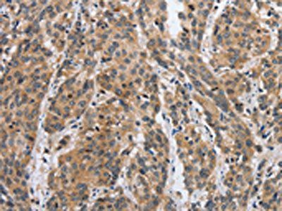 DSP Antibody