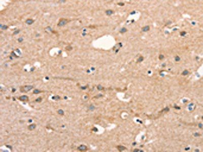 DSP Antibody
