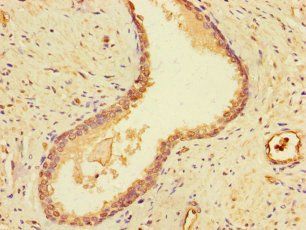 DSTN Antibody