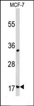 DSTN antibody