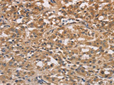 DSTN Antibody