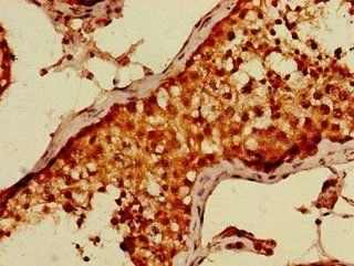 DTL Antibody
