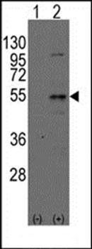 Dtnbp1 antibody