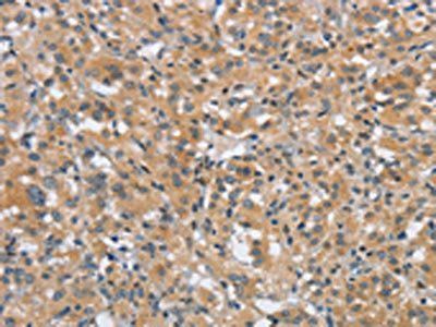 DTNBP1 Antibody