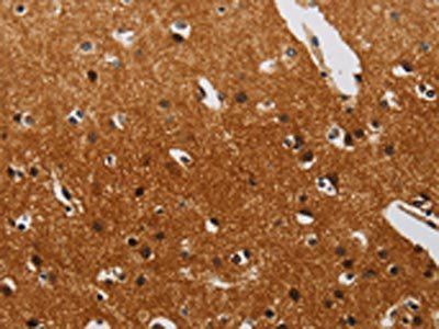 DTNBP1 Antibody