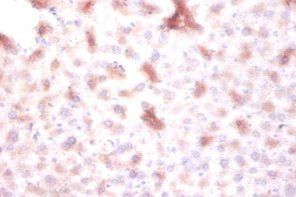 DTWD1 Antibody