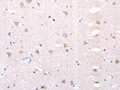 DTX1 Antibody