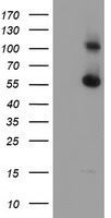 DTYMK Antibody