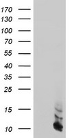 DTYMK Antibody
