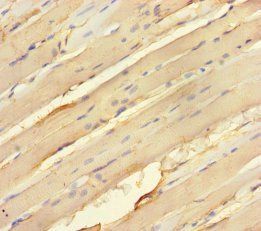 Dual specificity mitogen-activated protein kinase kinase 3 antibody