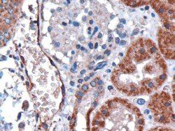 Goat anti-Duffy / FY / DARC Antibody