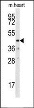 DUSP10 antibody