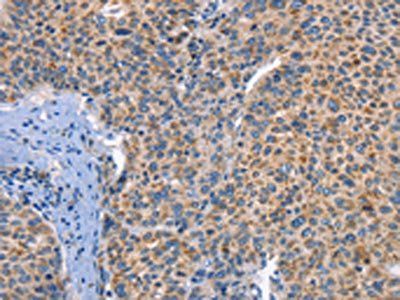 DUSP10 Antibody